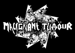 Malignant Tumor
